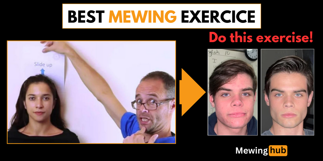 Dr. Mike Mew demonstrating the McKenzie chin tuck mewing exercise with before and after facial comparison images.