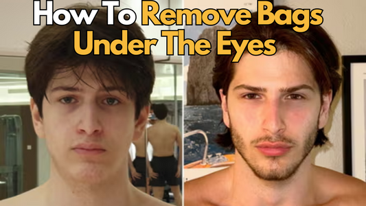 before and after images of a man removing his under eye bags with text saying how to remove bags under the eyes.