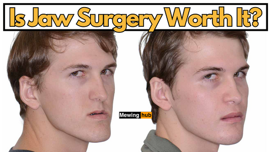 before and after picture of a man who got jaw surgery with text saying is jaw surgery worth it