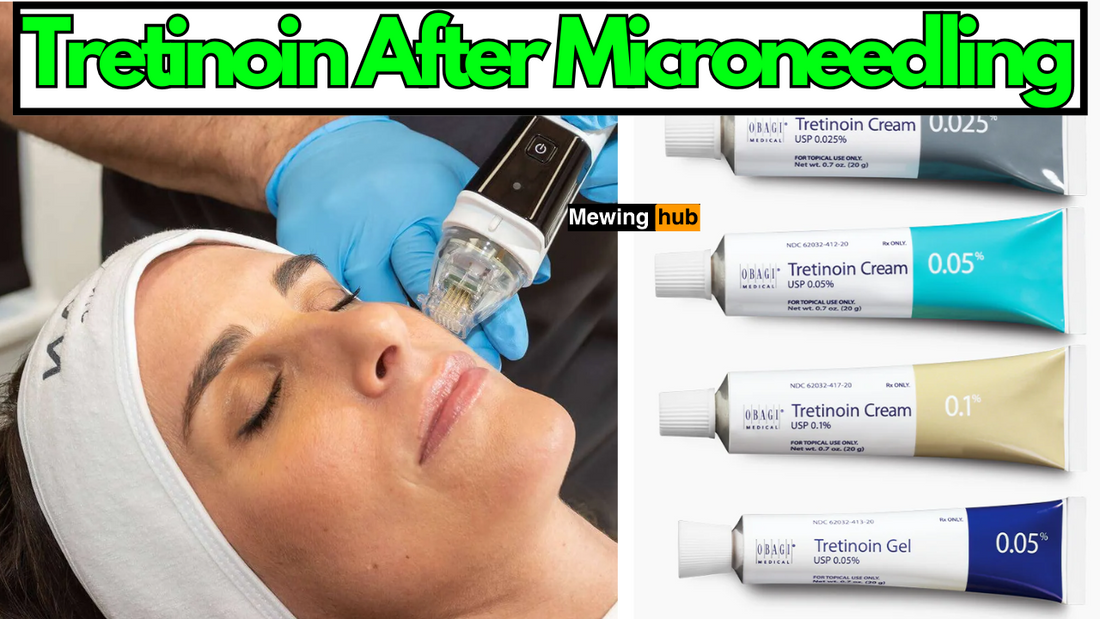 pictures of tretinoin cream and a woman getting microneedling treatment, with text saying tretinoin after microneedling.