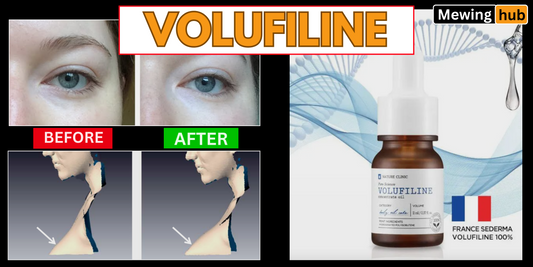 Before and after images showing the effects of Volufiline on facial volume, accompanied by a product bottle, highlighting the transformation and benefits of this beauty product.