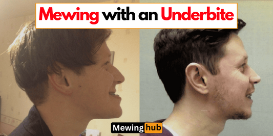 Side-by-side comparison of a man's facial profile before and after mewing with an underbite, highlighting potential improvements in jaw alignment and facial structure.
