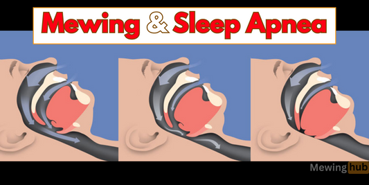 Does Mewing Help with Snoring or Sleep Apnea?