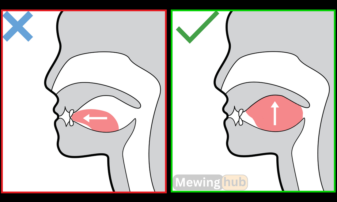 Illustrations showing proper mewing vs pushing the tongue on the front teeth