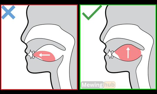 Illustrations showing proper mewing vs pushing the tongue on the front teeth