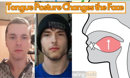 Image showing proper tongue posture.