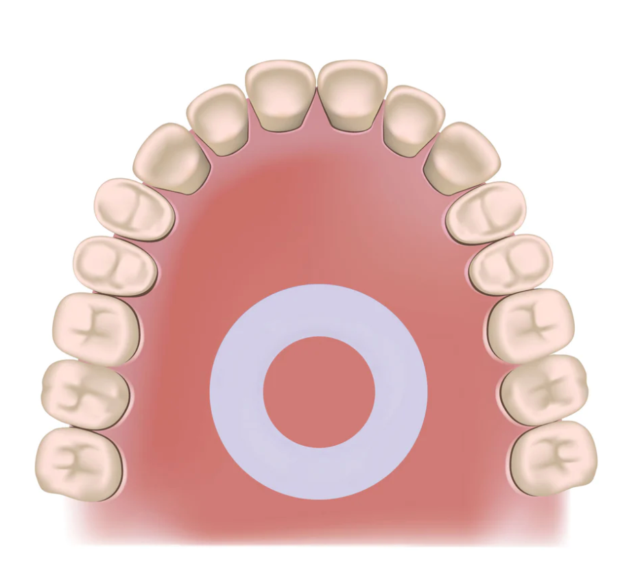 The Mewing Ring - Mewinghub