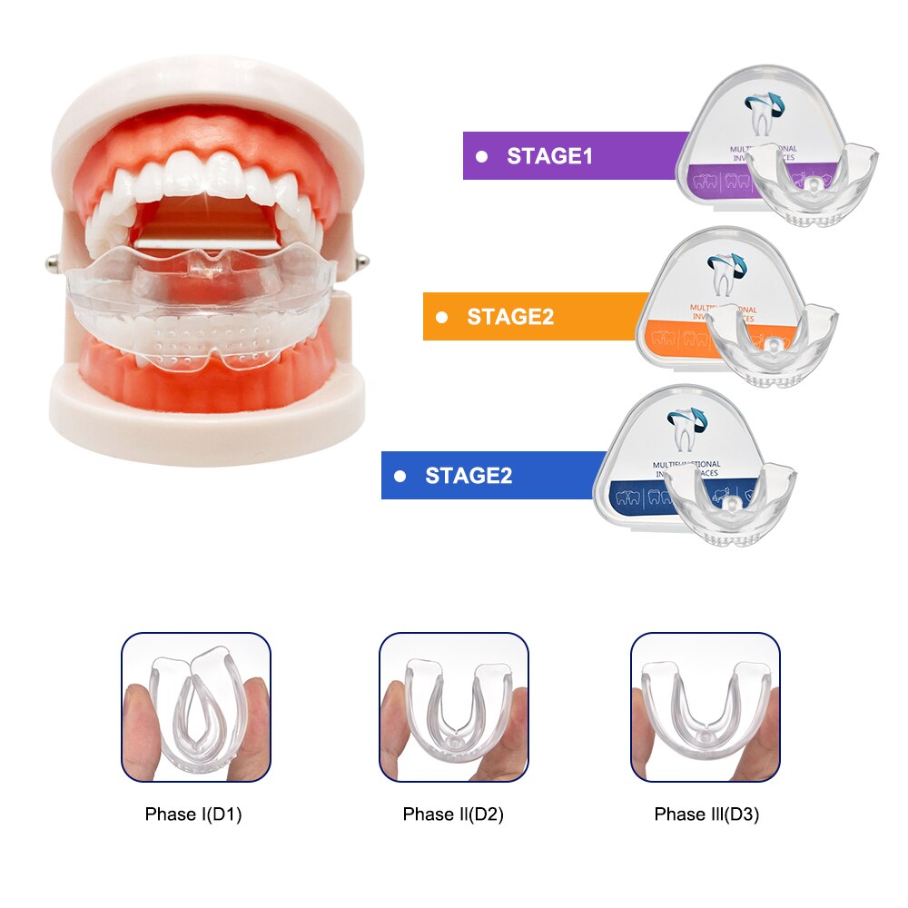 Mew Brace - Improve your tongue posture