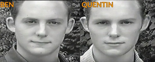 Photo comparison of twins Ben and Quentin showing differing facial development due to mewing versus orthodontics.