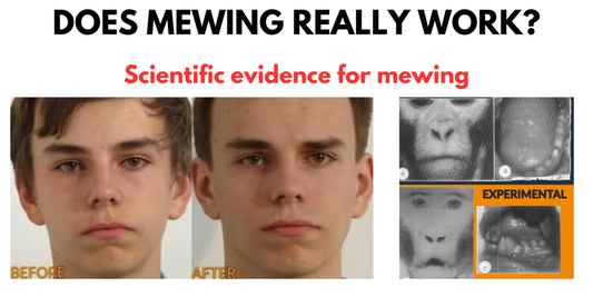 Does mewing really work? Scientific evidence for mewing with before and after images showing facial improvement.