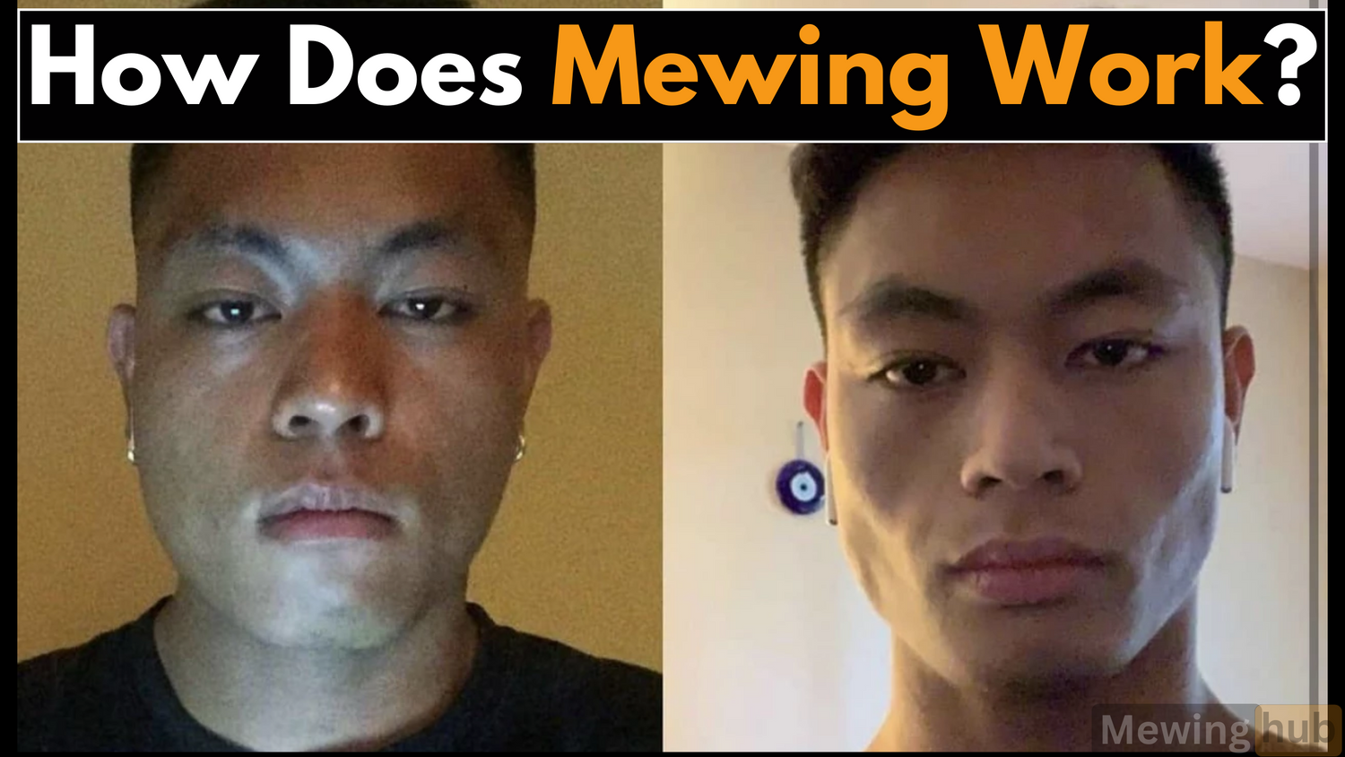 Mewing Before & After: 5 Incredible Transformations ! | Mewinghub