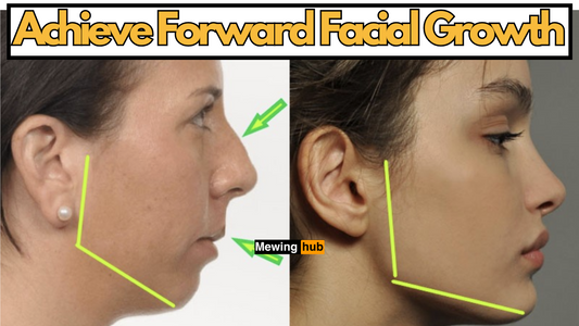 pictures explaining what foward facial growth is.