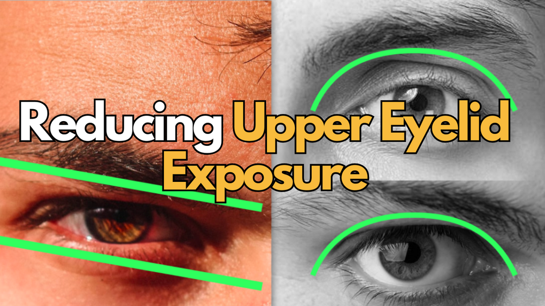 images of men's eyes showing what is upper eyelid exposure with text saying reducing upper eyelid exposure