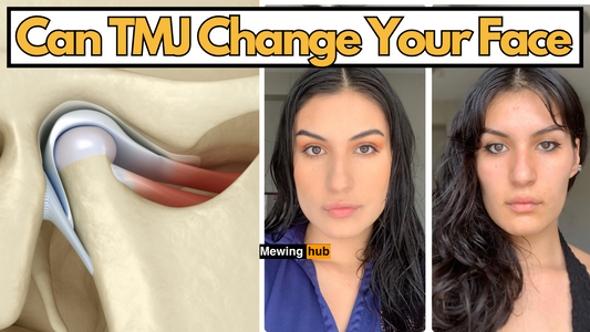 illustration of TMJ and a before and after picture of someone fixing their TMJ with text saying can TMJ change your face. 