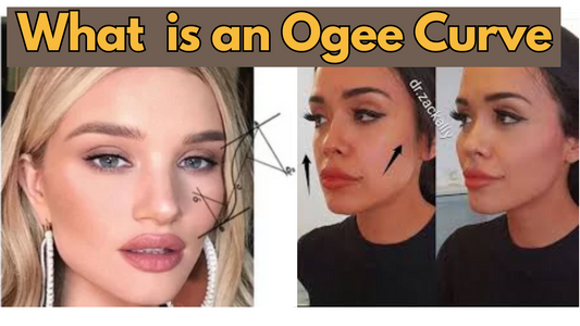 Images explaining what an ogee curve is.