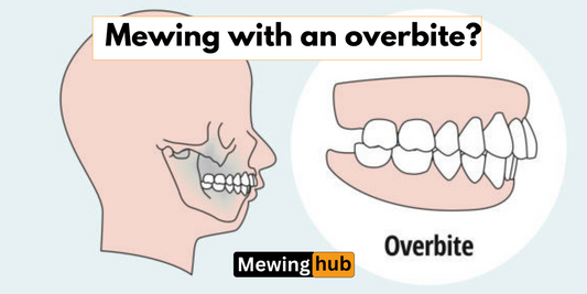 Informative diagram explaining the impact of mewing on correcting an overbite, with illustrations of jaw and teeth positioning.