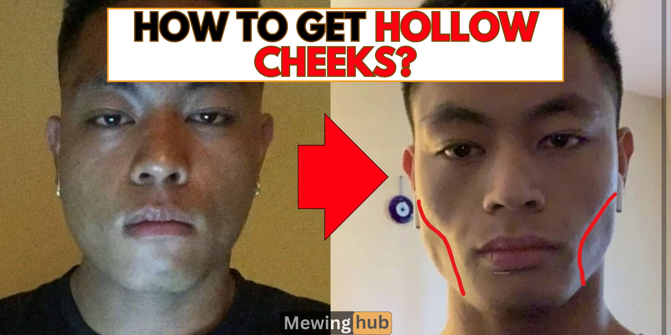 Achieving Hollow Cheeks Effective Techniques for a Sculpted Face