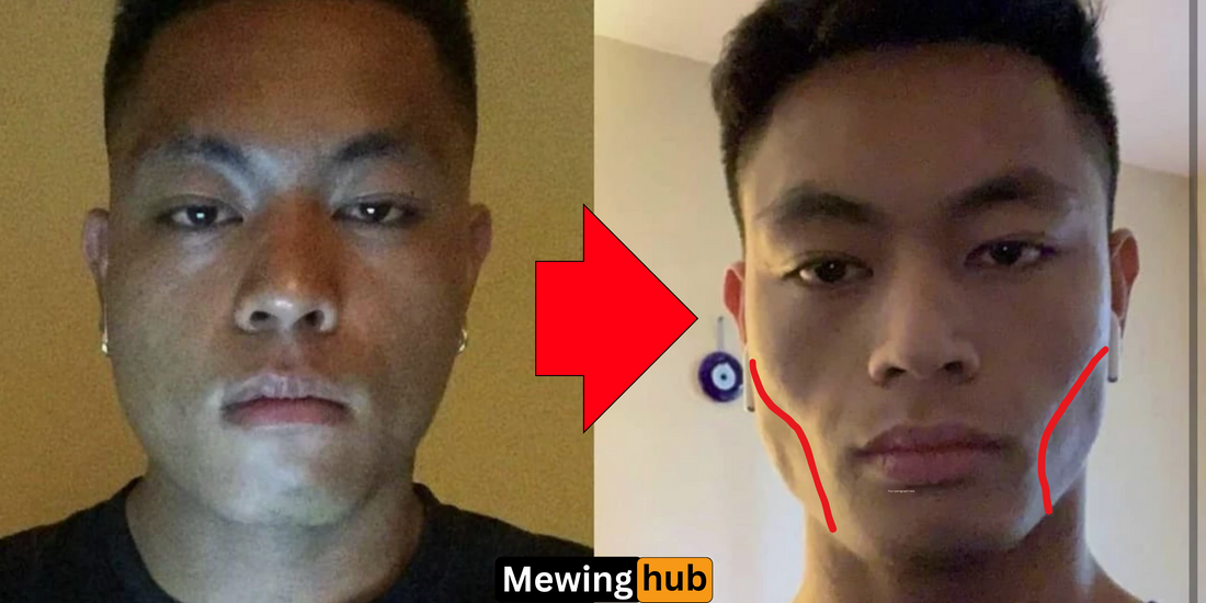 before and after transformation of chewing and mewing