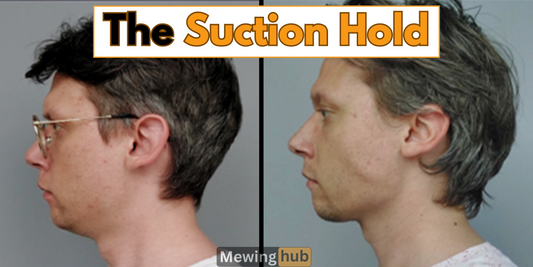 Before and after images of a man's profile with text 'The Suction Hold' highlighting the benefits of this mewing technique.
