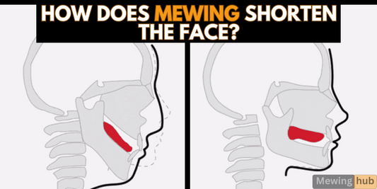 Illustration showing the impact of mewing on facial structure, highlighting how proper tongue posture can lead to a shorter face by promoting maxillary up-swing.