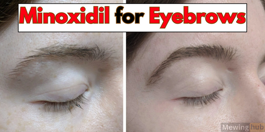 Before and after images showing the effects of Minoxidil on eyebrow growth, highlighting improved density and definition.