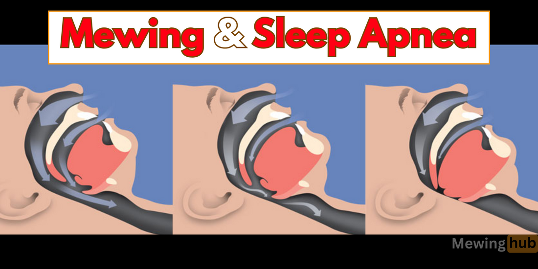 A diagram showing how snoring occurs, making a connection between mewing and sleep apnea.
