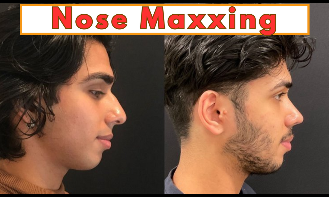 before and after transformation of someone who has improved their nose visa nosemaxxing.