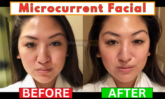 comparison pictures showing the changes in the face from microcurrent facial.