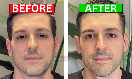 Before and after images from using gua sha, showing improvements in facial definition.