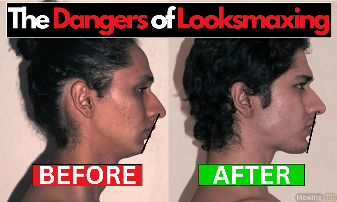 Side profile comparison images titled 'The Dangers of Looksmaxing' showing a man before and after looksmaxing, illustrating significant changes in facial features.