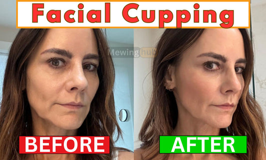 Before and after of a women who did facial cupping, showing a clear improvement.