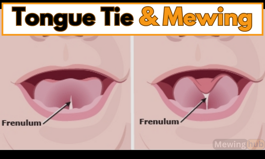 Diagram showing a comparison of a normal tongue versus a tongue with a tie, highlighting the frenulum's impact on tongue mobility for mewing.