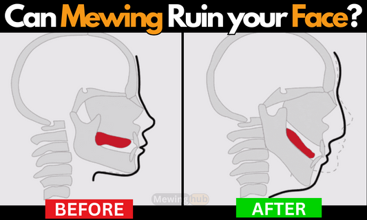 Diagram comparing before and after effects of mewing on facial structure, highlighting potential negative changes in jaw alignment and tongue position.
