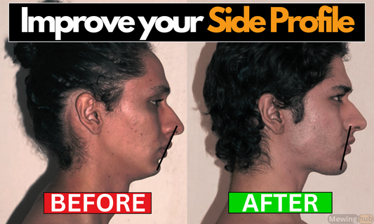 Before and after images showing enhanced side profile from mewing technique, demonstrating significant facial improvements.
