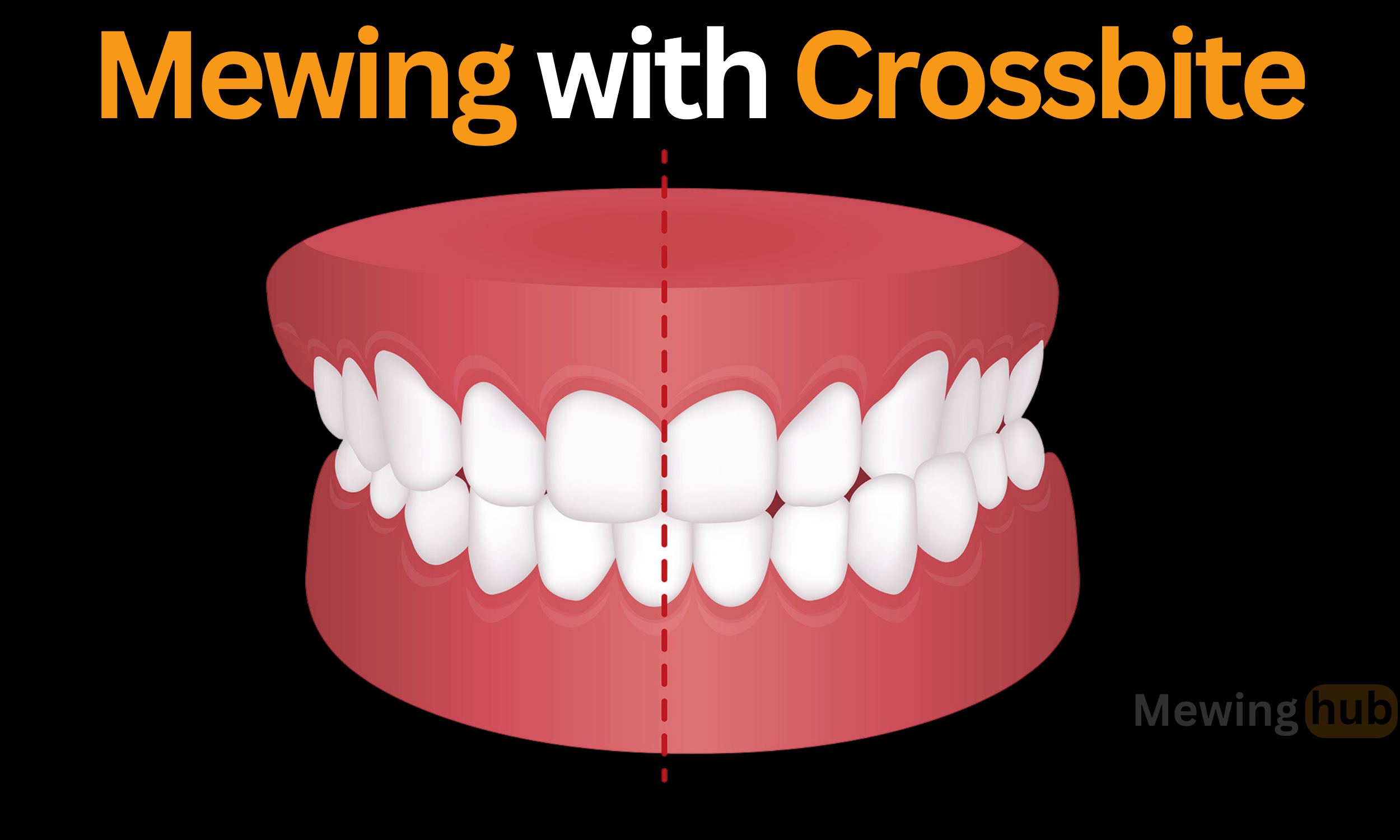 Mewing with Crossbite: Techniques and Tips | Mewinghub