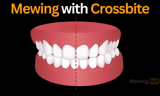 Illustration of crossbite with text 'Mewing with Crossbite' highlighting dental misalignment and mewing benefits.
