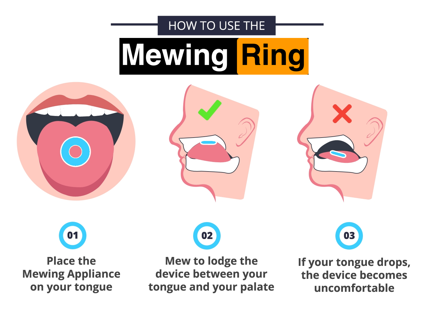 The Mewing Ring