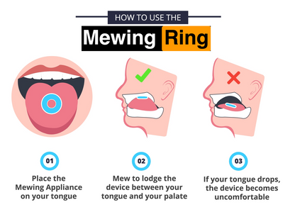 The Mewing Ring